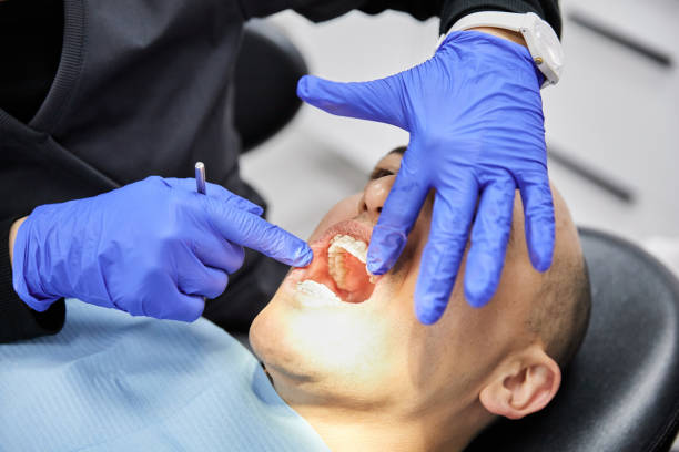 Best Emergency Wisdom Teeth Removal in Castle Shannon, PA